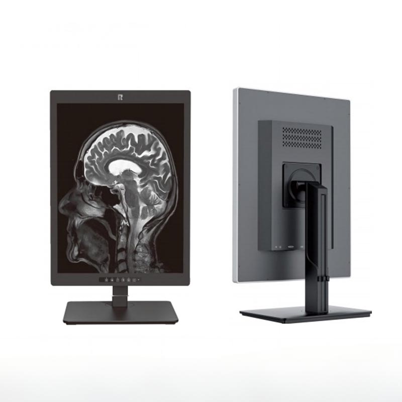 Medizinischer 20,1-Zoll-2MP-Diagnosemonitor
