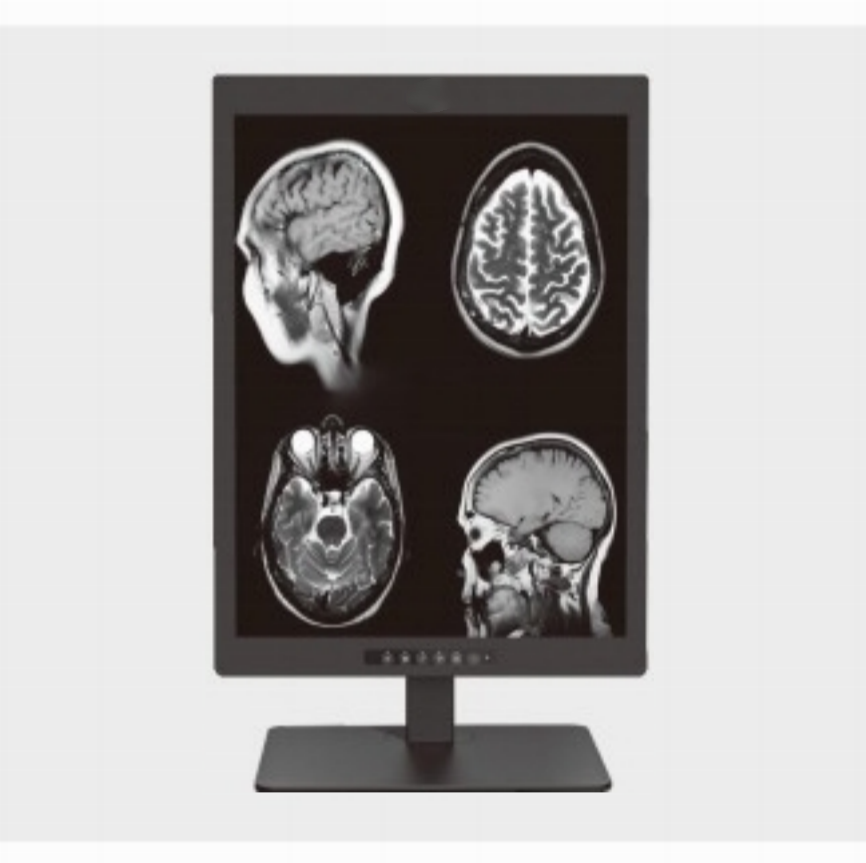 Wo wird häufig ein 20,1-Zoll-2MP-Display für medizinische Diagnosen verwendet?