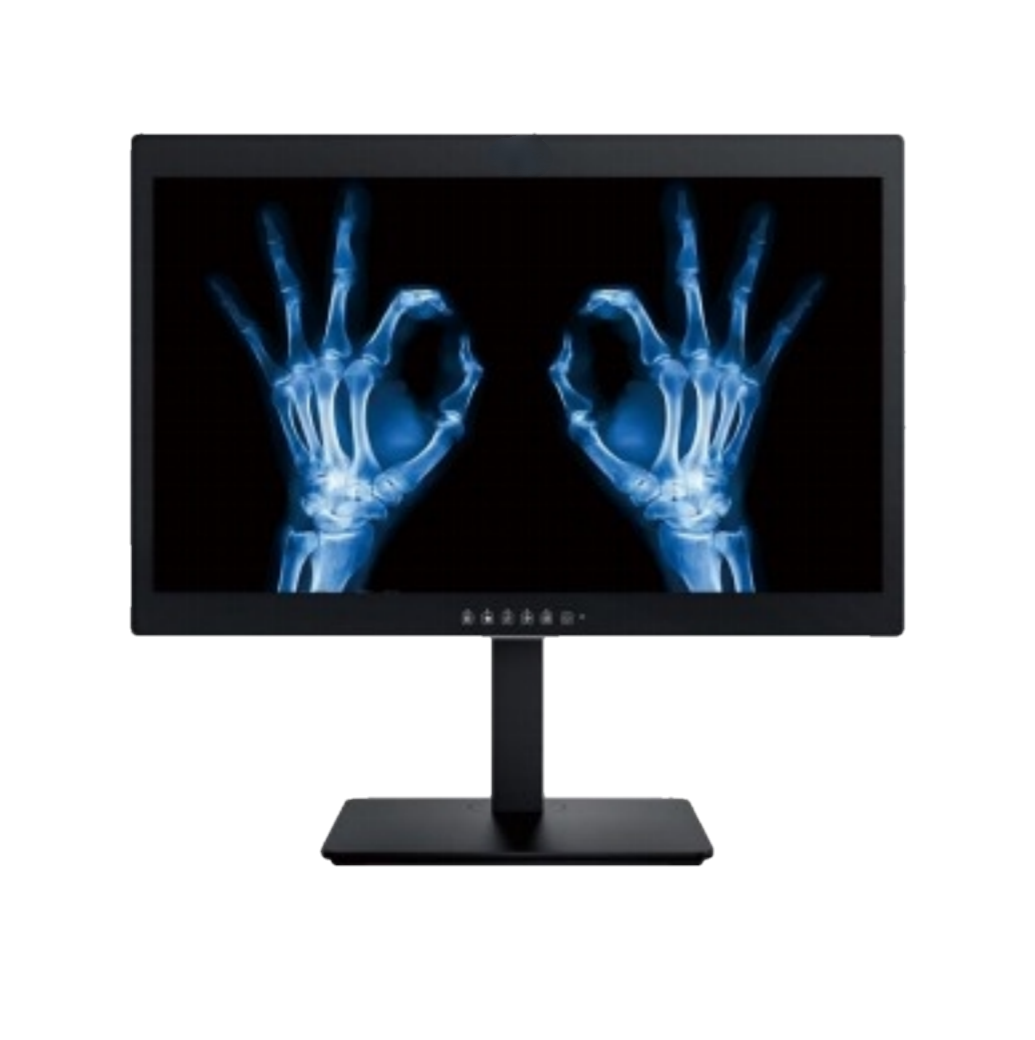 Glauben Sie, dass 24-Zoll-2MP-Displays für die medizinische Diagnostik in Krankenhäusern nur normale kommerzielle Computermonitore sind?