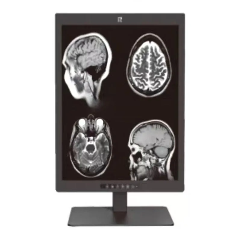 21,3-Zoll-3MP-Display für medizinische Diagnose