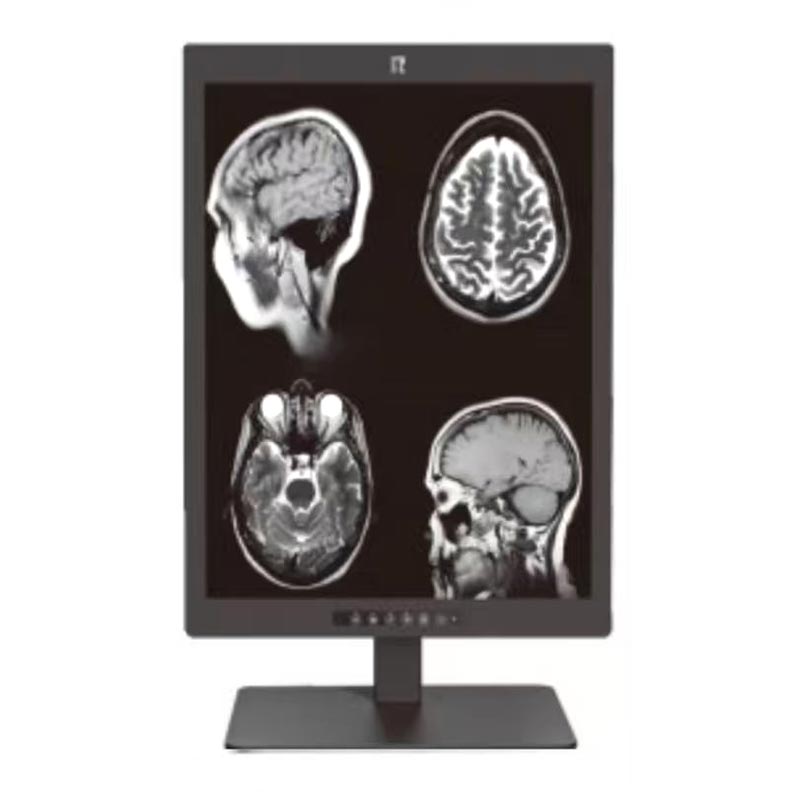 Medizinischer 21,3-Zoll-3MP-Diagnosemonitor