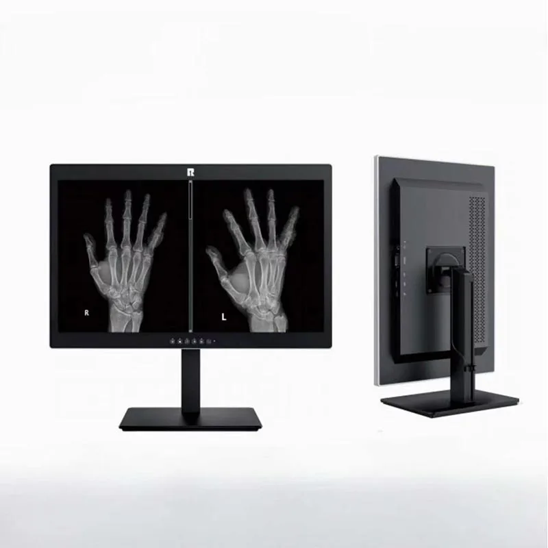 24-Zoll-2MP-Display für medizinische Diagnose