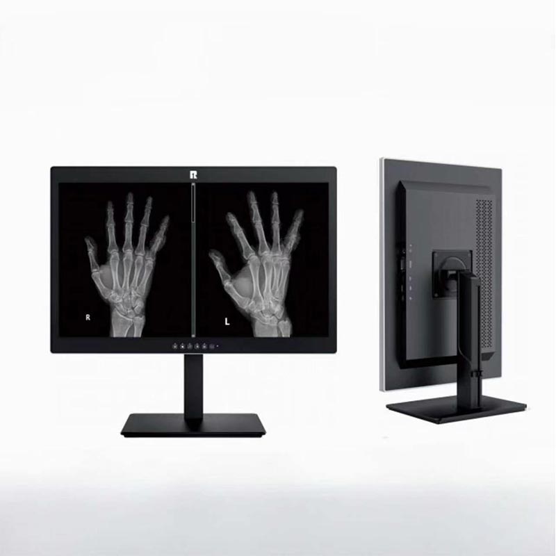 Medizinischer 24-Zoll-2MP-Diagnosemonitor