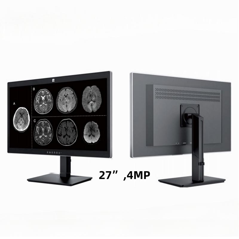 27-Zoll-4MP-Display für medizinische Diagnose