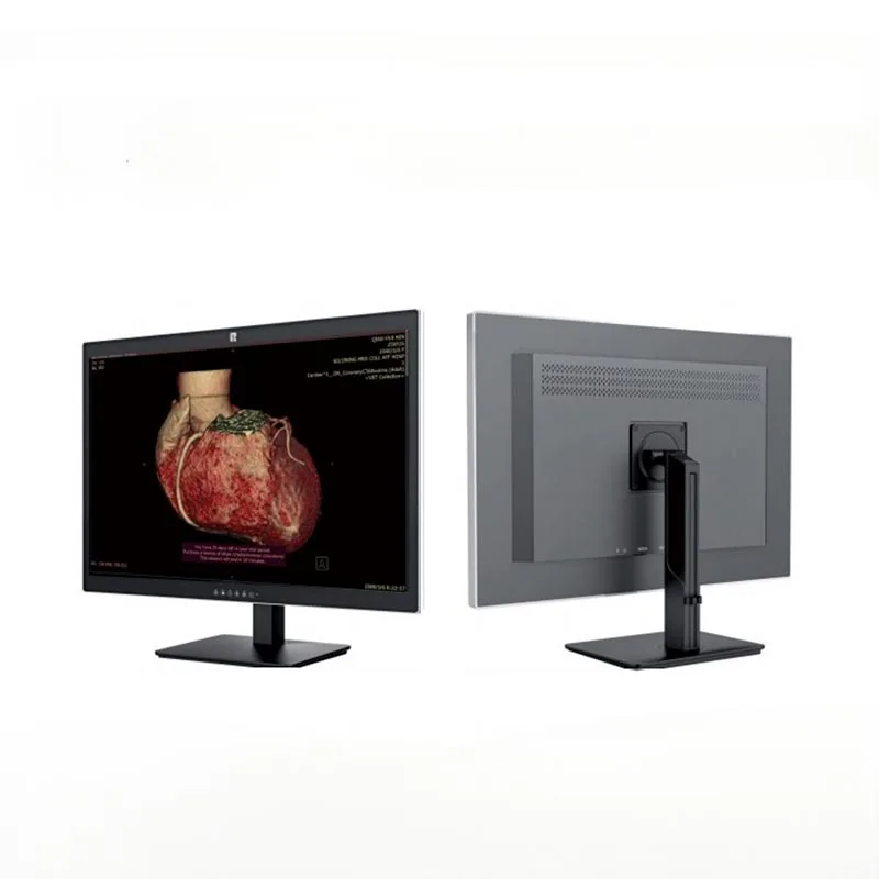 Medizinischer 30-Zoll-6MP-Diagnosemonitor