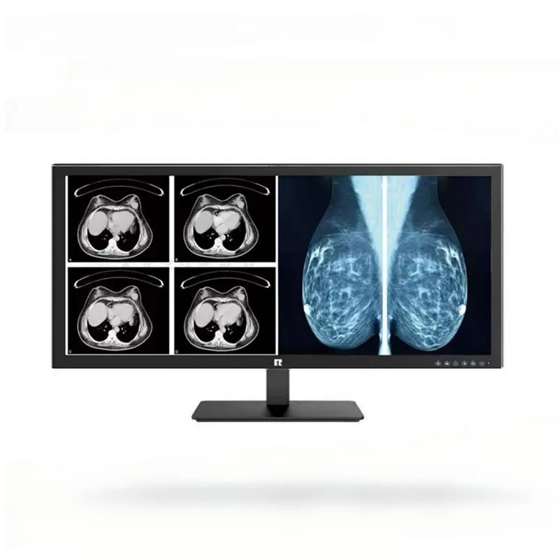 Medizinischer 34-Zoll-5MP-Diagnosemonitor