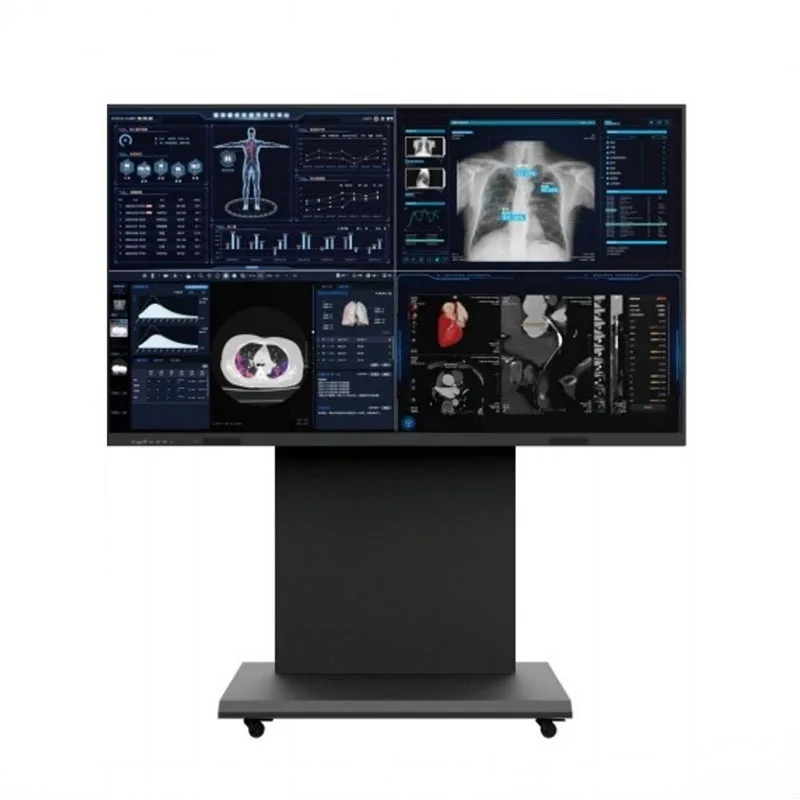 86-Zoll-8MP-Monitorterminal für medizinische Beratung