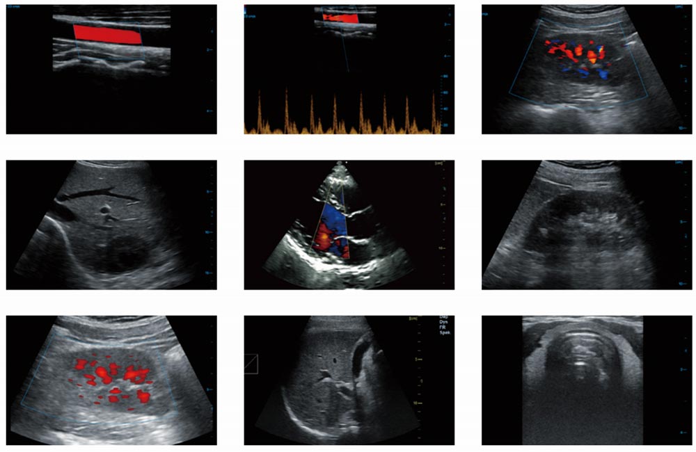 Handheld Ultrasound Machine