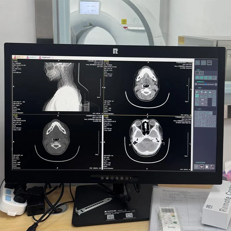 20.1-inch 2MP Medical Diagnostic Display